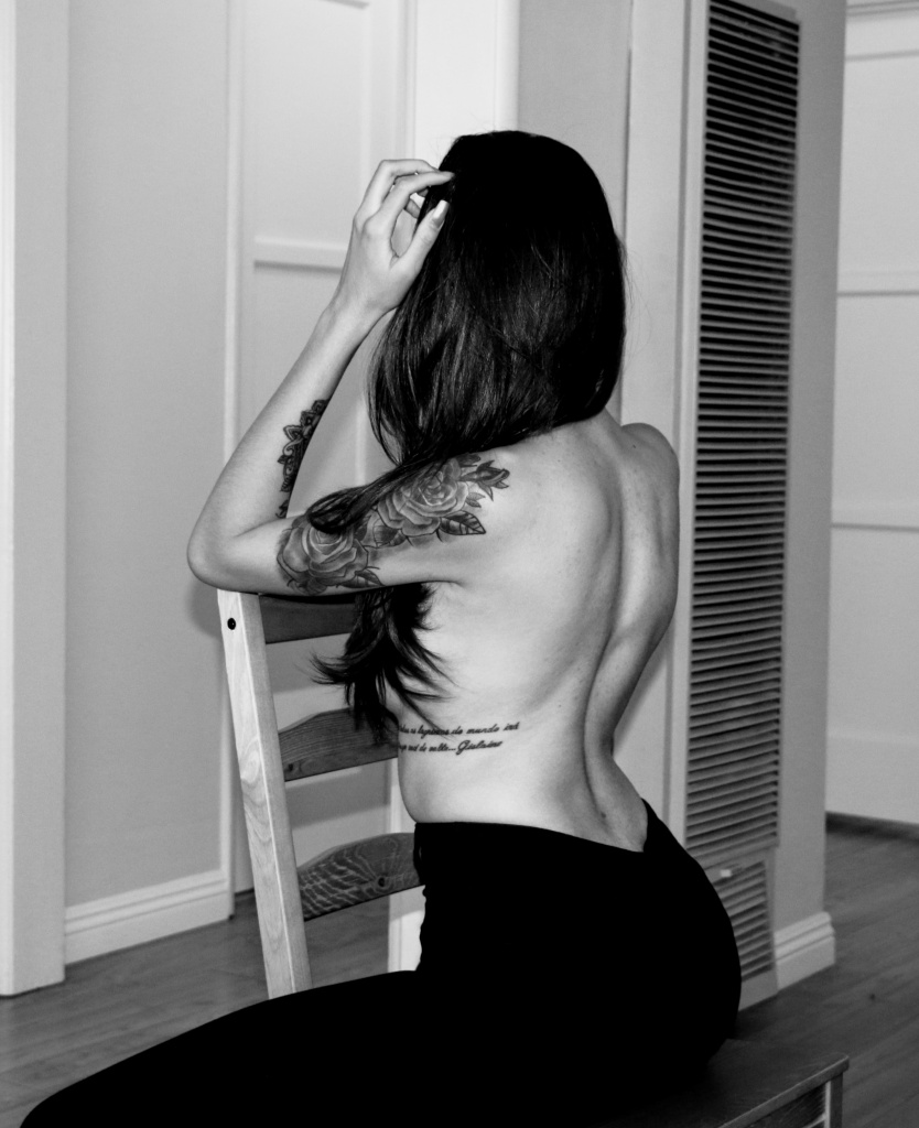 ESCOLIOSE O QUE É ? MINHA HISTÓRIA